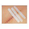 Leukosan hechtstrip 6 mm x 75 mm 10 x vel à 3 strips voorbeeld