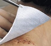 Metalline steriel nonwoven kompres 10 cm x 12 cm - per stuk