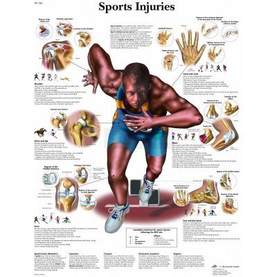 Ingelijste poster Sports Injuries - sportblessures