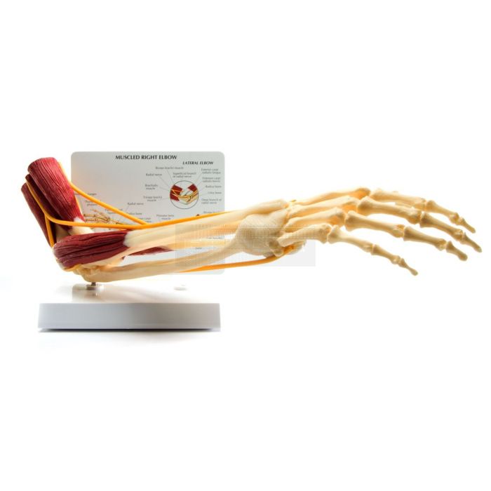 Elleboog met spieren en infokaart