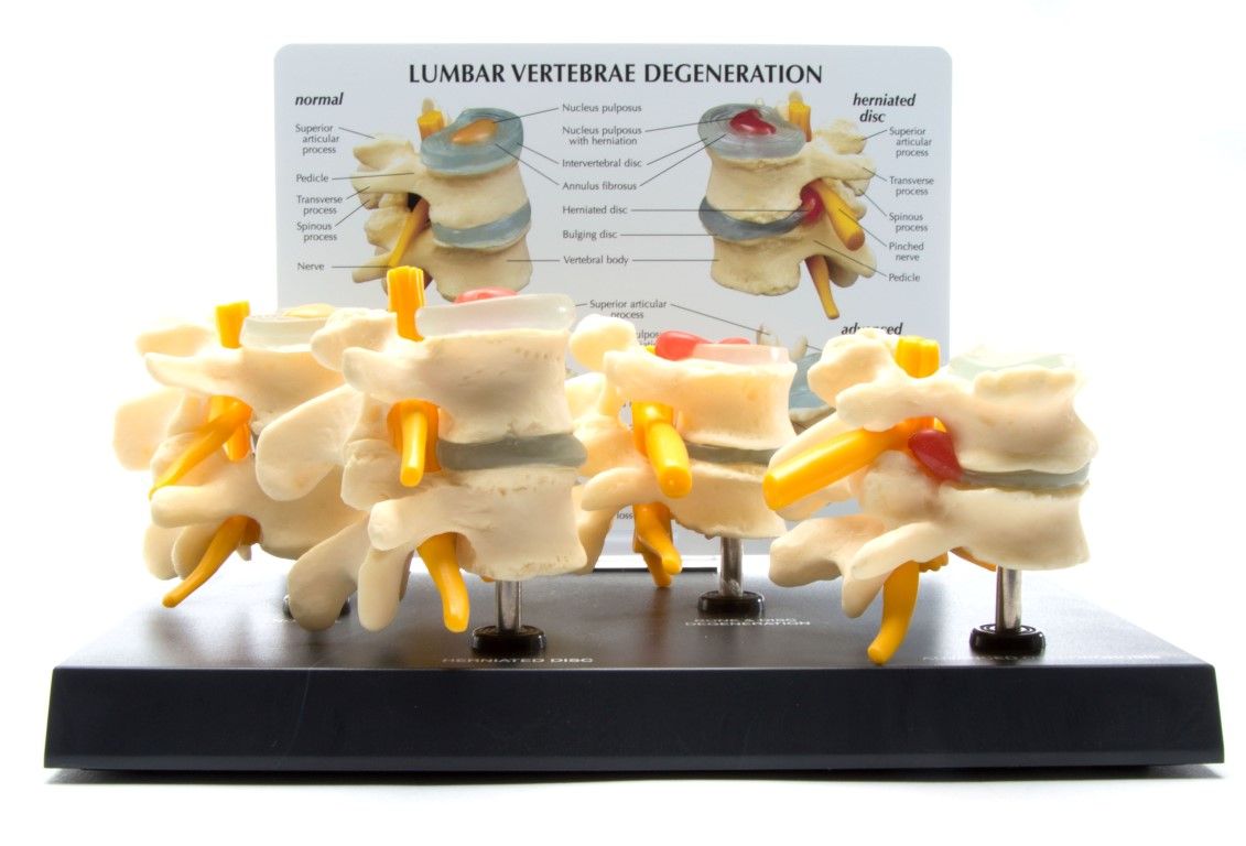 Ruggenwervels, 4 stadia op ware grootte